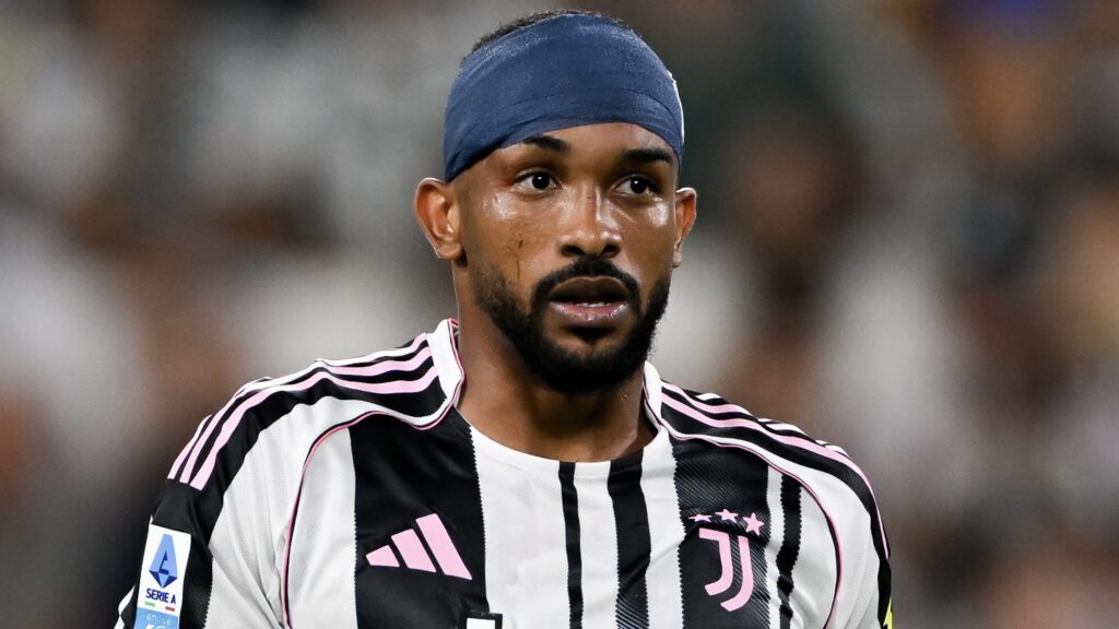 Juventus FC v Parma Calcio 1913 - Serie A